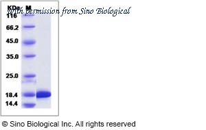 Sino Biological 15282-H07E image 1
