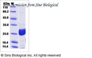 Sino Biological 15286-H08E image 1
