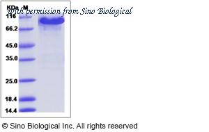 Sino Biological 51122-M02H image 1