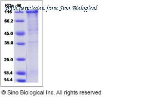 Sino Biological 13408-H02H image 1