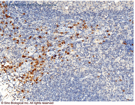 Sino Biological 10345-MM01 image 1