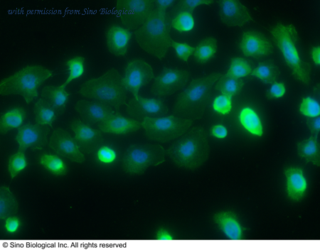 Sino Biological 10046-MM06 image 1