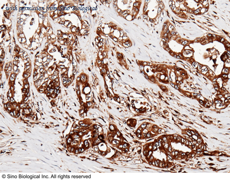 Sino Biological 11091-RP02 image 1