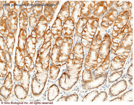 Sino Biological 10186-MM05 image 1