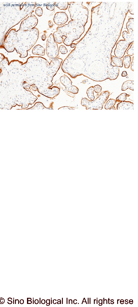 Sino Biological 10628-R001 image 1