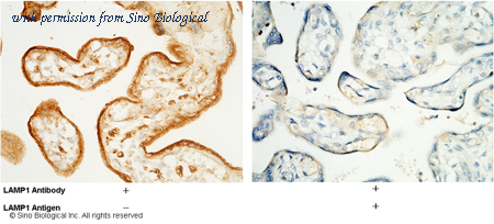 Sino Biological 11215-MM07 image 1