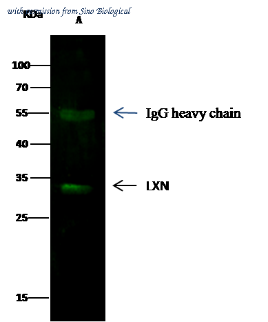 Sino Biological 10211-MM04 image 1