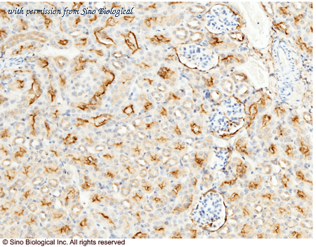 Sino Biological 50001-R101 image 1