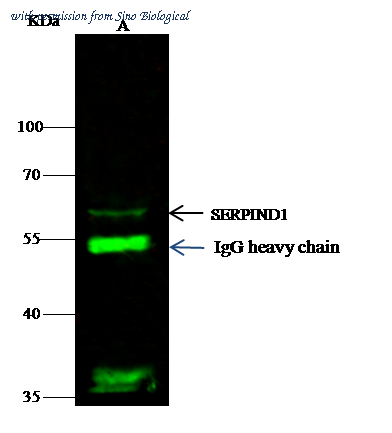Sino Biological 50121-R025 image 1
