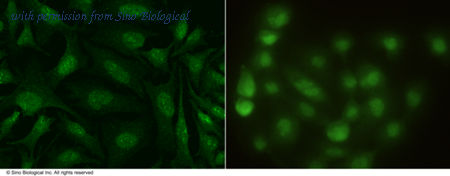 Sino Biological 10991-MM07 image 1