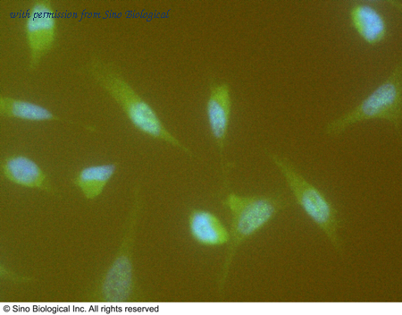 Sino Biological 11013-MM02 image 1