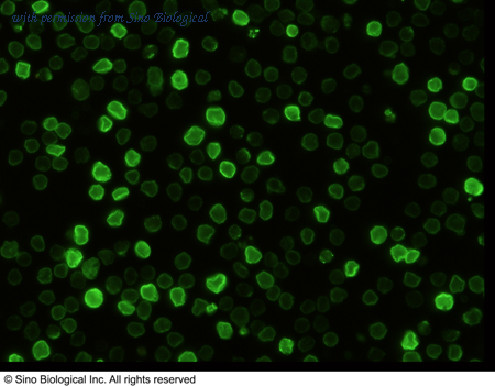 Sino Biological 50332-R041 image 1