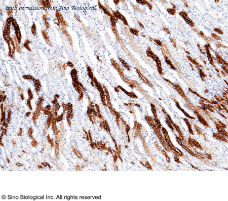 Sino Biological 50057-R001 image 1