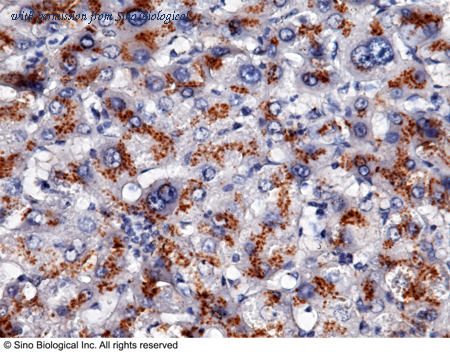 Sino Biological 11221-R003 image 1