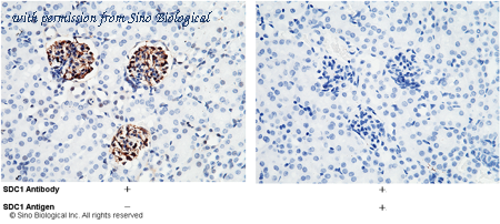 Sino Biological 50641-RP02 image 1