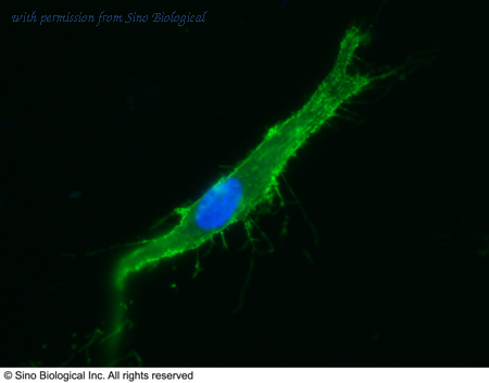 Sino Biological 10346-MM01 image 1