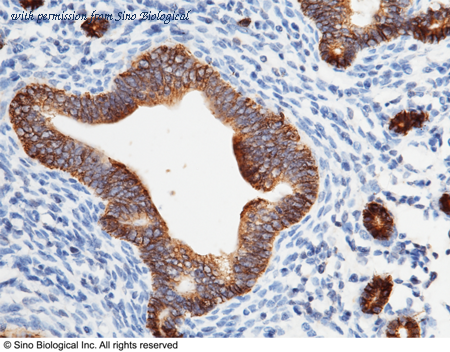 Sino Biological 50591-RP02 image 1