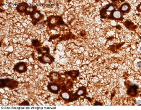 Sino Biological 50281-R009 image 1