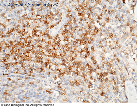 Sino Biological 10400-R113 image 1