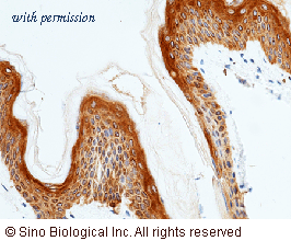 Sino Biological 10397-R024 image 1
