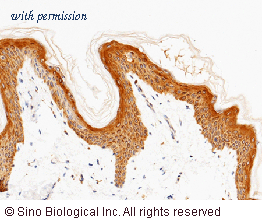 Sino Biological 10397-R038 image 1