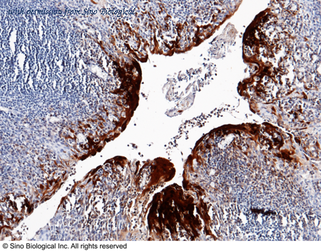 Sino Biological 11141-R129 image 1
