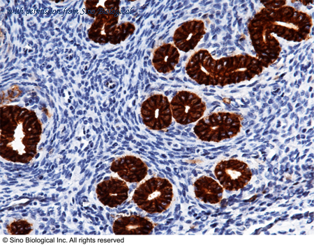 Sino Biological 50591-R002 image 1