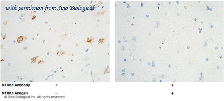 Sino Biological 11073-R024 image 1