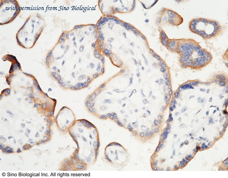 Sino Biological 10084-R015 image 1