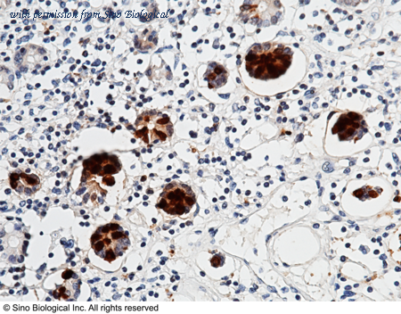 Sino Biological 11235-R019 image 1