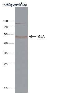 Sino Biological 12078-R001 image 1