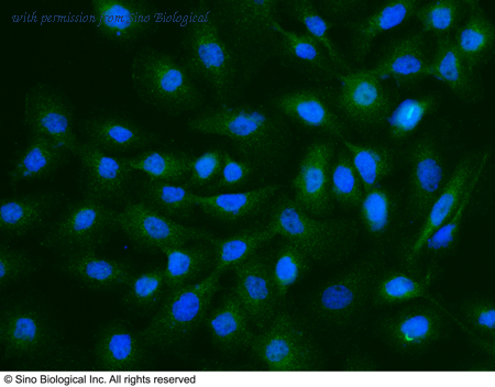 Sino Biological 11639-MM12 image 1