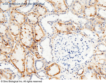 Sino Biological 11429-RP02 image 1
