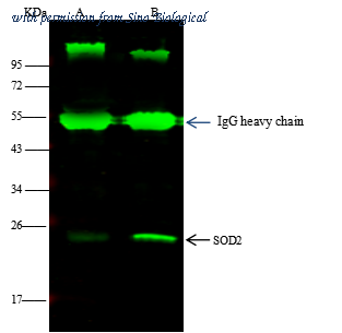 Sino Biological 12656-R001 image 1