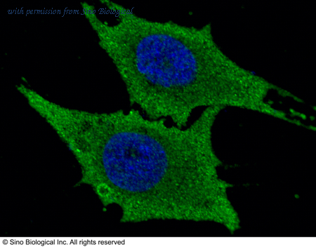 Sino Biological 10276-R201 image 1