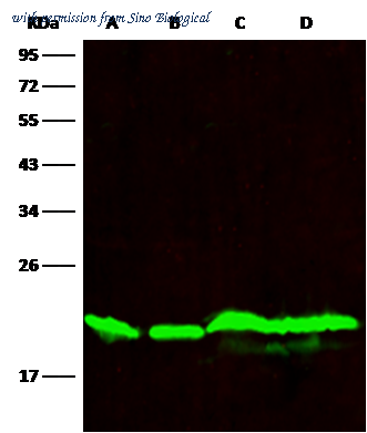 Sino Biological 10339-R006 image 1