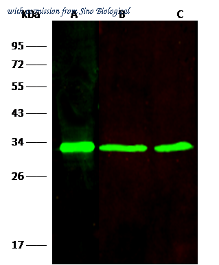 Sino Biological 10754-R208 image 1