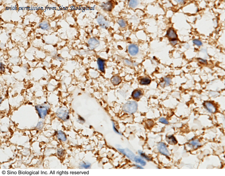 Sino Biological 100139-RP02 image 1
