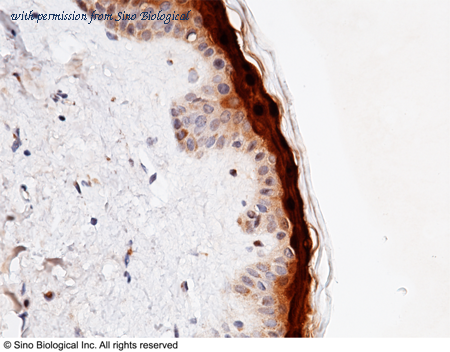 Sino Biological 11783-R119 image 1
