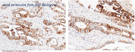Sino Biological 11360-MM05 image 1
