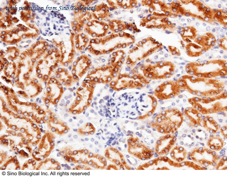 Sino Biological 50281-R011 image 1