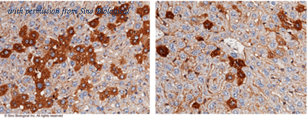 Sino Biological 50093-R022 image 1