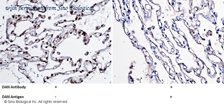 Sino Biological 10169-MM01 image 1