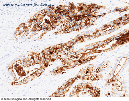 Sino Biological 11077-R327 image 1