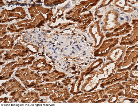 Sino Biological 10549-R128 image 1