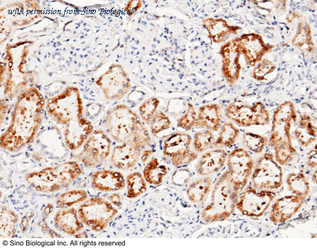 Sino Biological 11100-M003 image 1