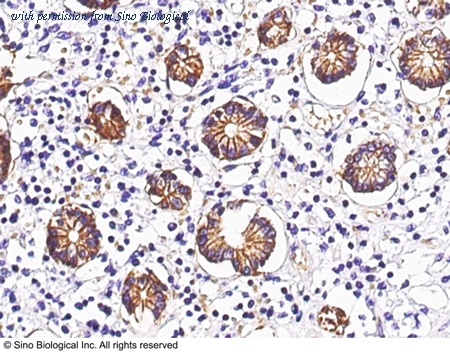Sino Biological 11277-R071 image 1
