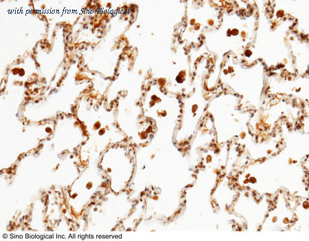 Sino Biological 10161-RP02 image 1