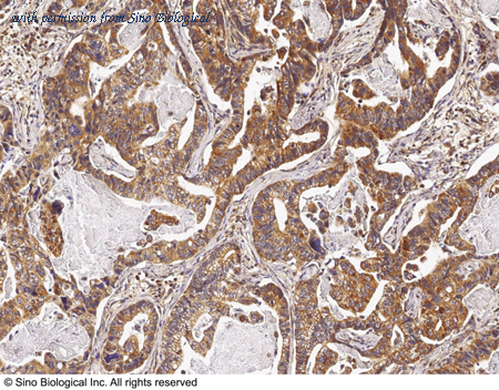 Sino Biological 11091-R301 image 1