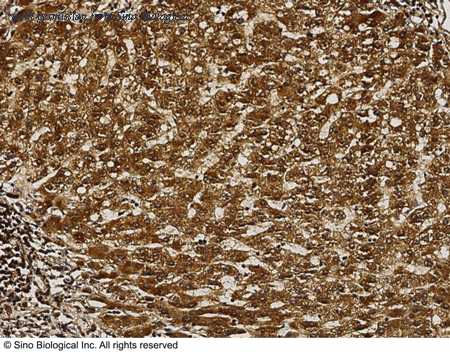 Sino Biological 13146-R025 image 1